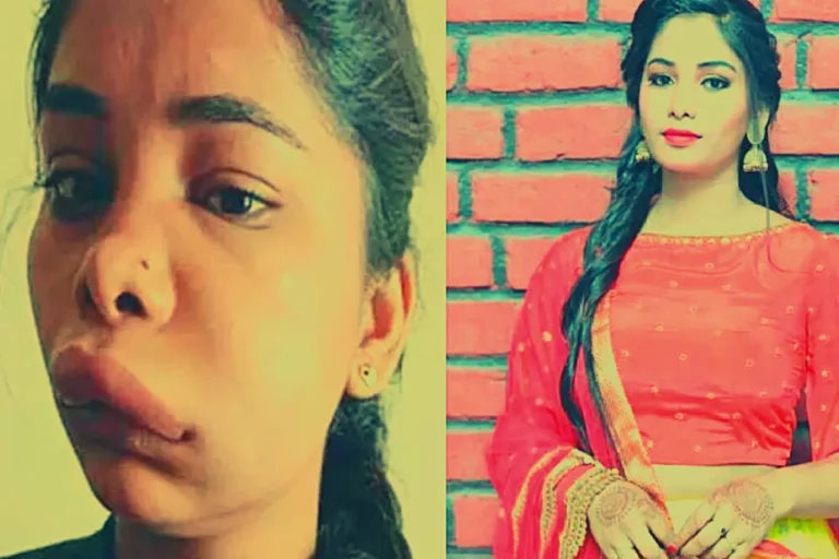 Swathi Sathish Damaged face of Kannada film actress from root canal